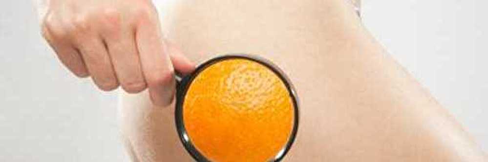 Cellulite-1.jpg